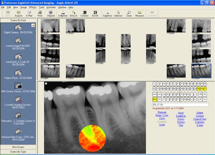 dental-imaging-software-feature-in-EagleSoft