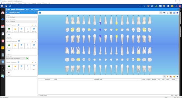 ABELDent charting screen