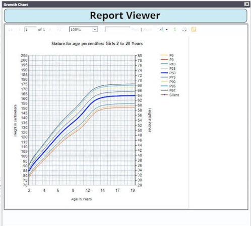 Report viewer