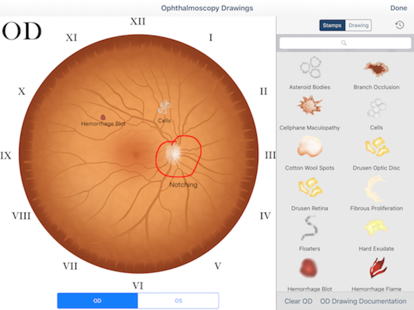Ophthalmoscopy drawings