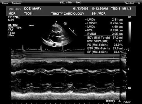 Ultrasound