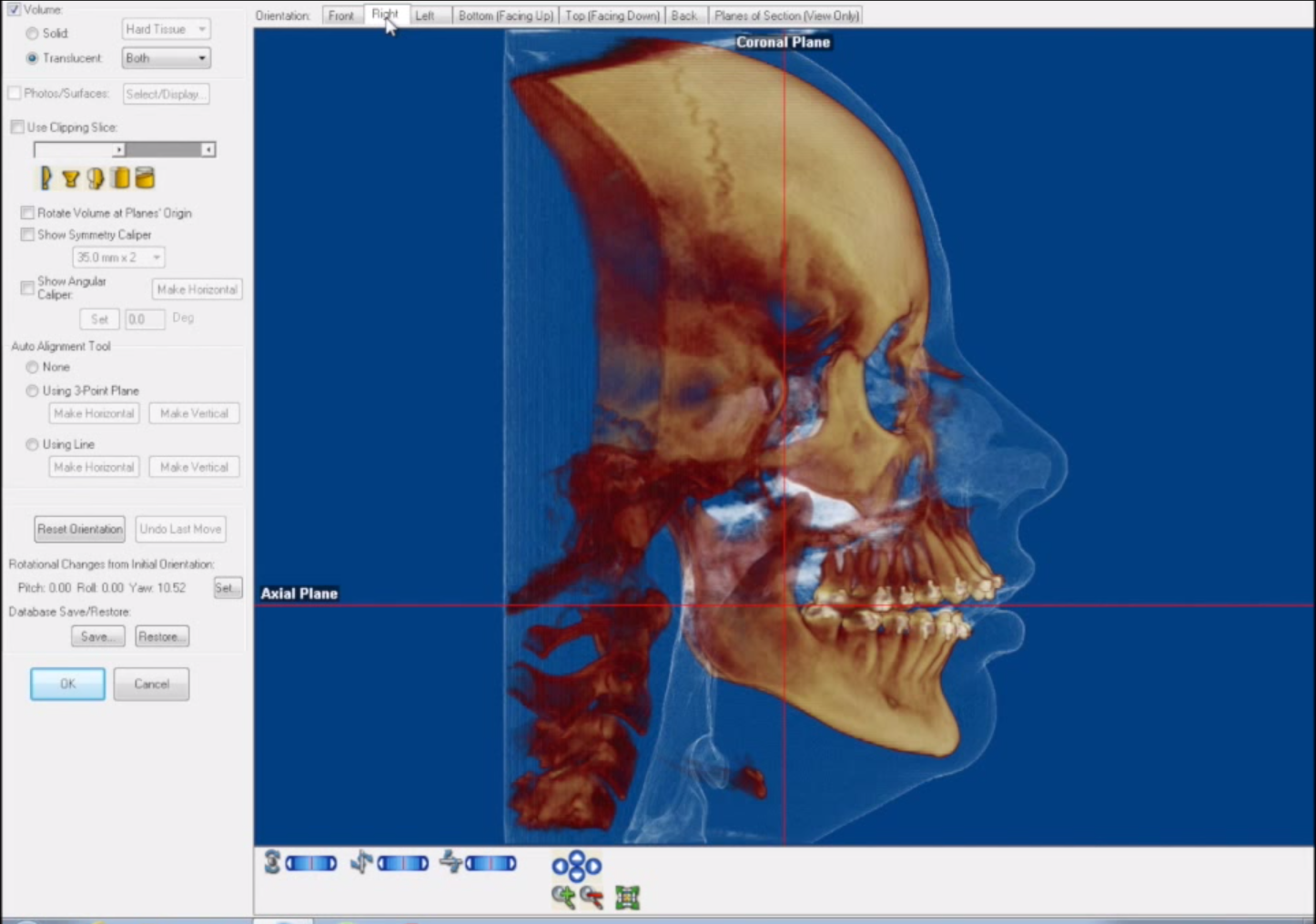 kodak dental imaging software keygen