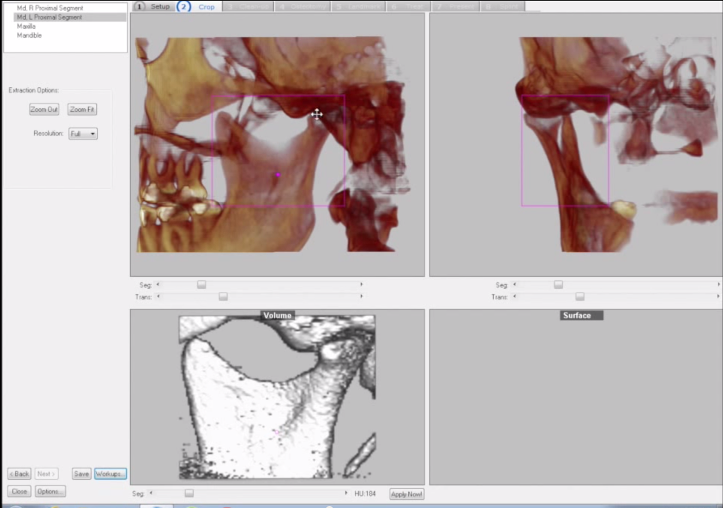 dolphin imaging torrent