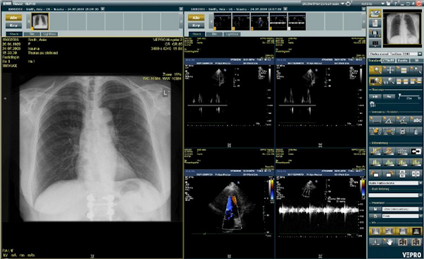 EMR viewer, lungs