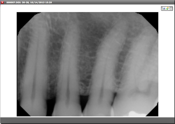 X-rays