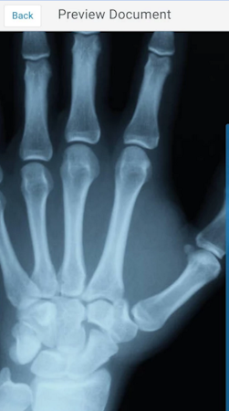 Mobile x-ray viewer