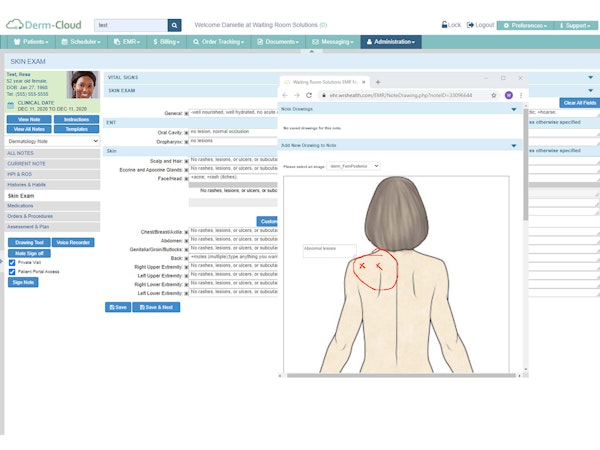 Skin Exam