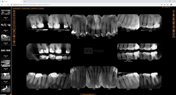 Full-mouth series